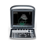 Digital Portable Ultrasound with Led Monitor