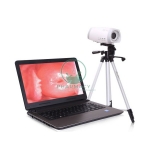 Laptop Video Colposcope